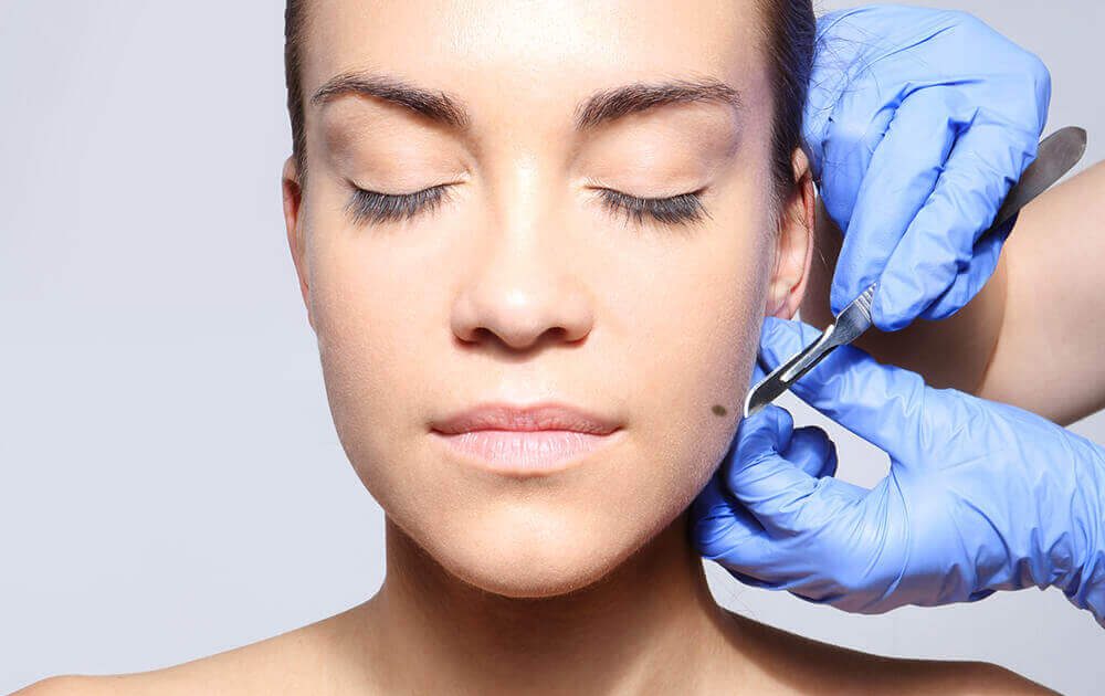 Biopsy