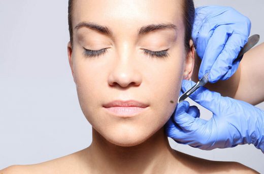 Biopsy