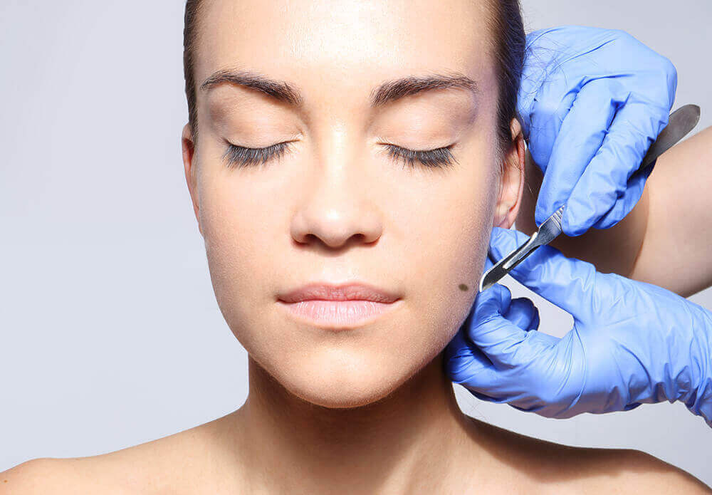 Biopsy