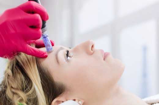 Microneedling Microneedling