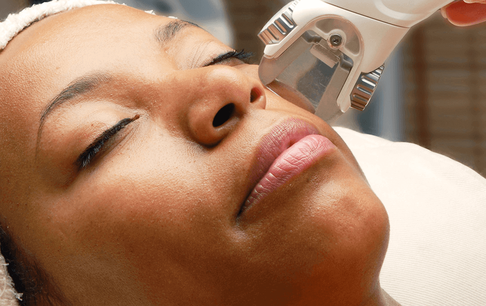 Skin Resurfacing