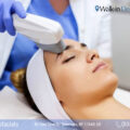 IPL photofacial