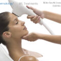 IPL photofacial treatment