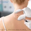 dermatologist checking out patient's mole with magnifying glass