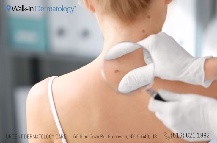 What To Know Before Going To A Dermatologist - Walk-in Dermatology