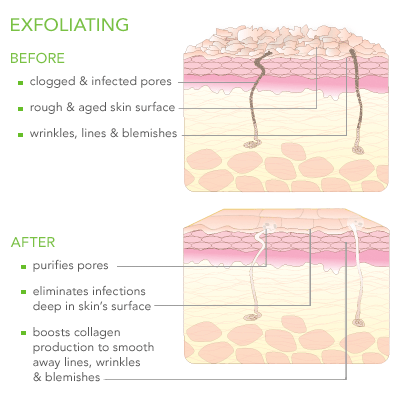 Exfoliating Before and After