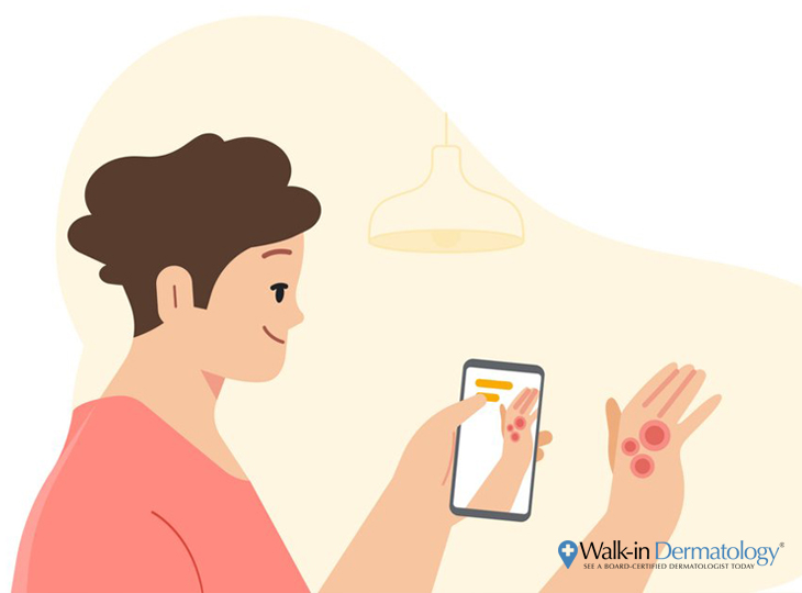 Google AI Skin App