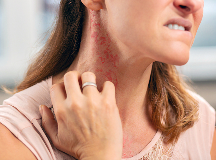 Walk-in Dermatology - What Kind of Skin Rash do I Have?